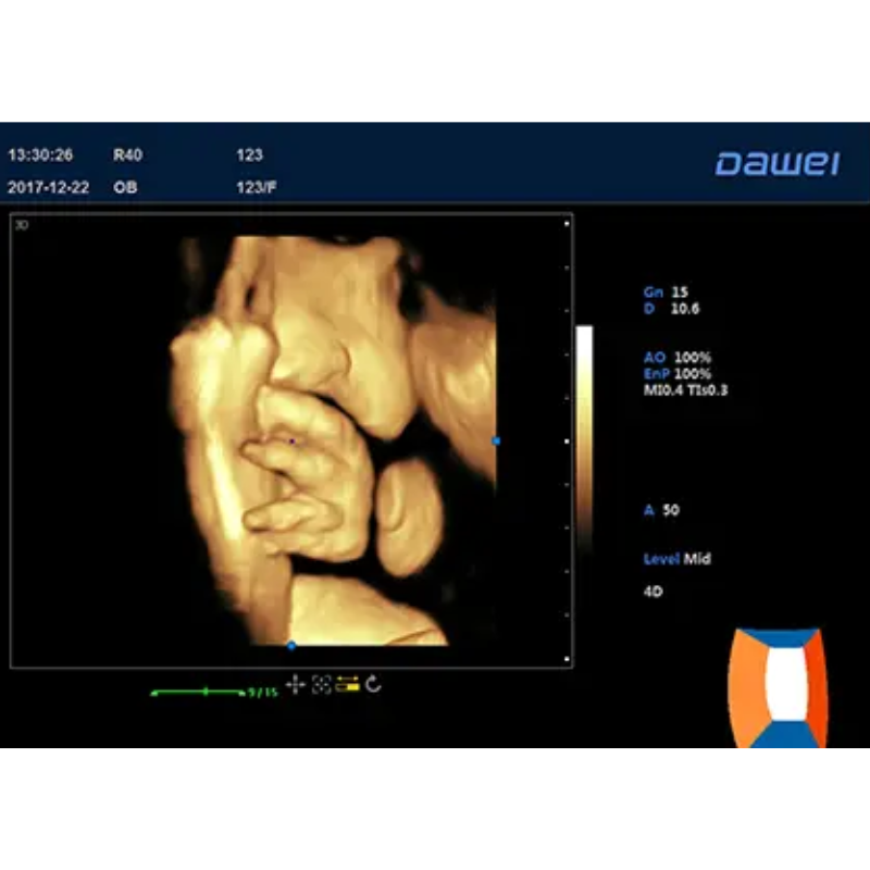 Echographe doppler DAWEI DW-T6