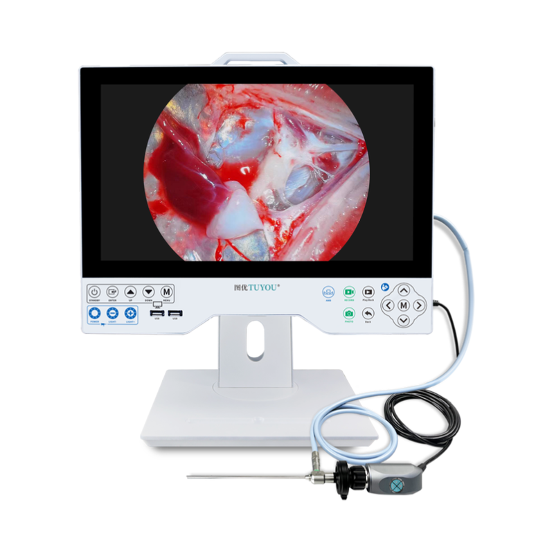 Système de caméra d'endoscopie médicale tout-en-un de 15,6 pouces avec stockage intégré de 256 Go et source lumineuse LED de 100 W